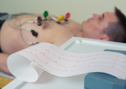Ein Patient mit EKG Ableitungen